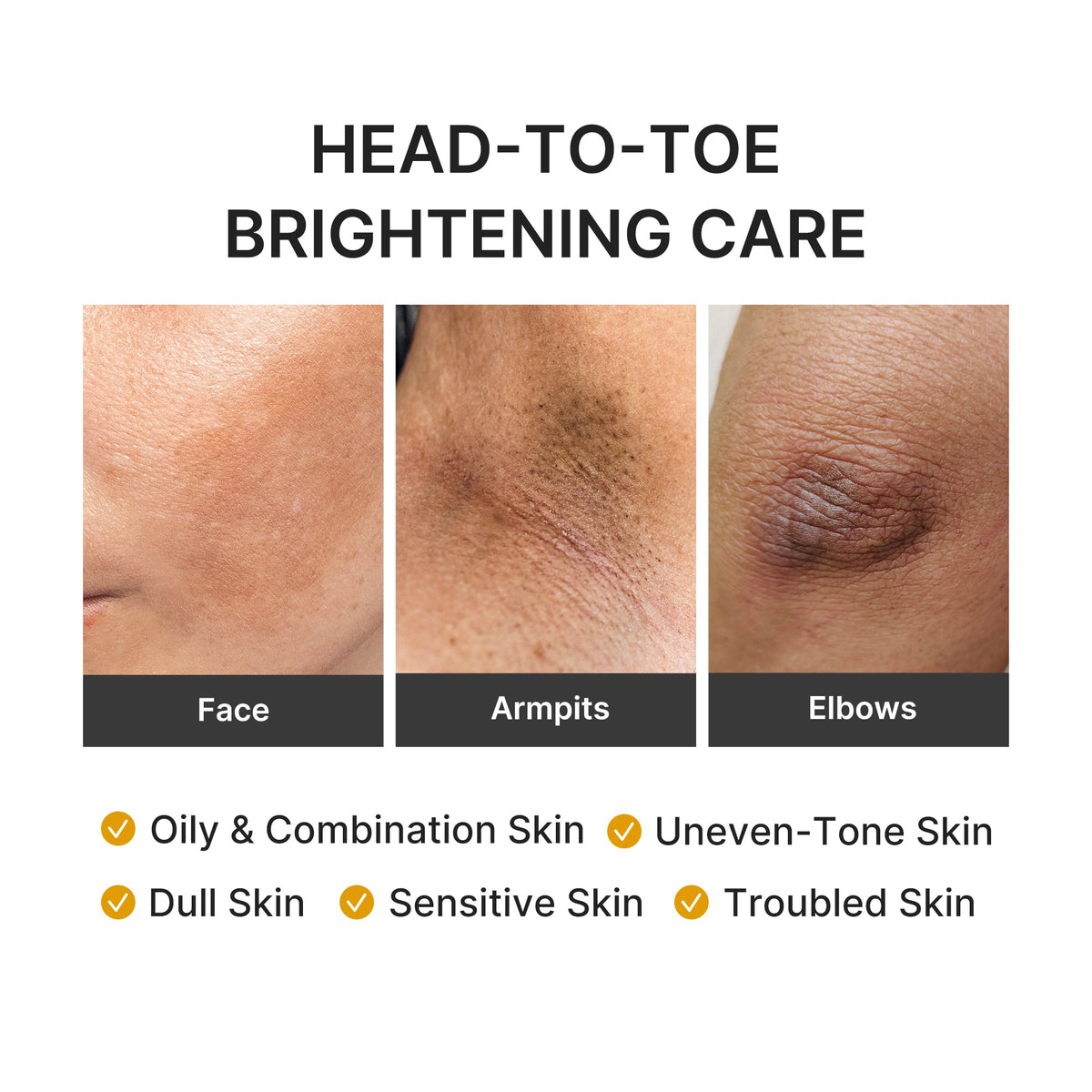 Head-to-toe brightening care for face, armpits and elbows; suits oily, combination, dull and uneven-tone skin