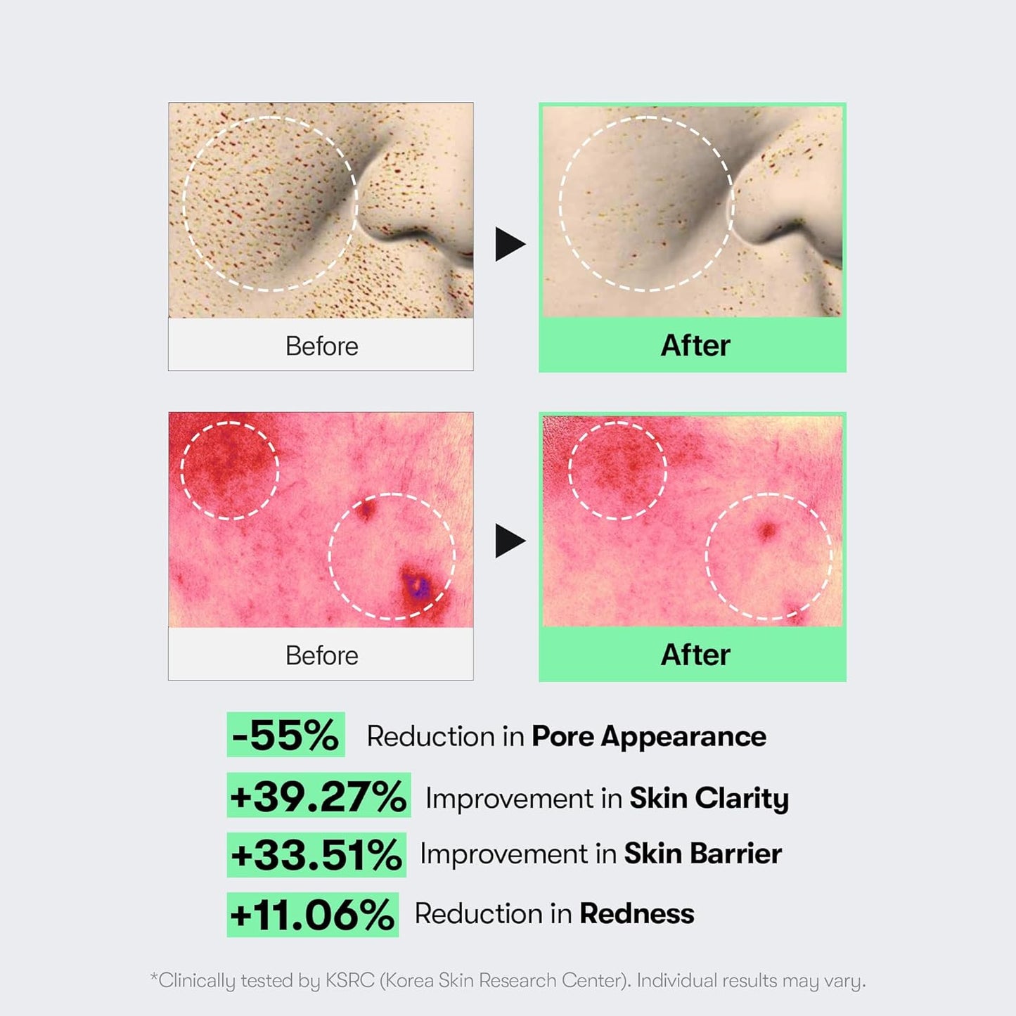 VT Cosmetics CICA Reedle Shot 100 - VT Cosmetics K-Beauty