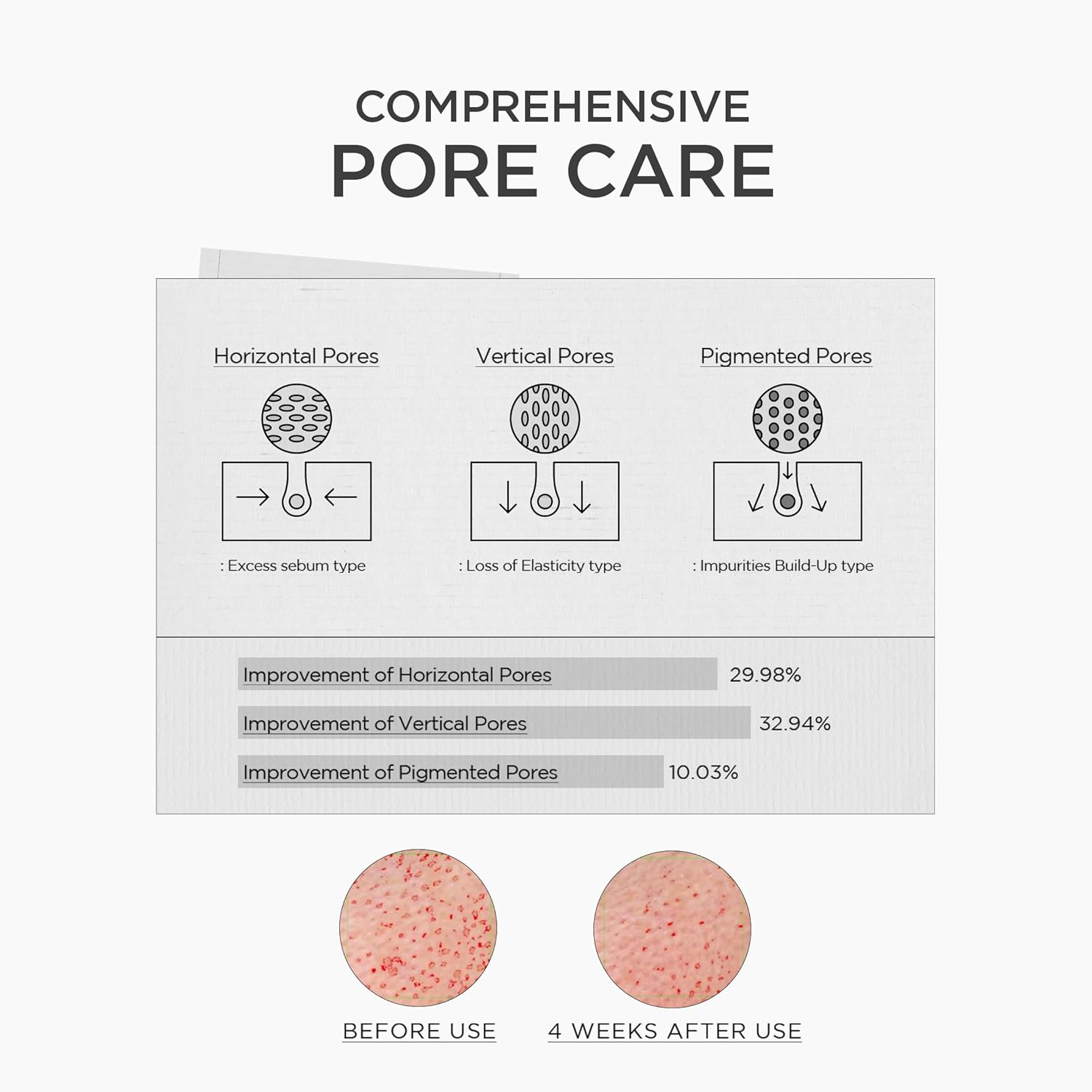 SKIN1004 Niacinamide 10% Boosting Ampoule 30ml - SKIN1004 K-Beauty
