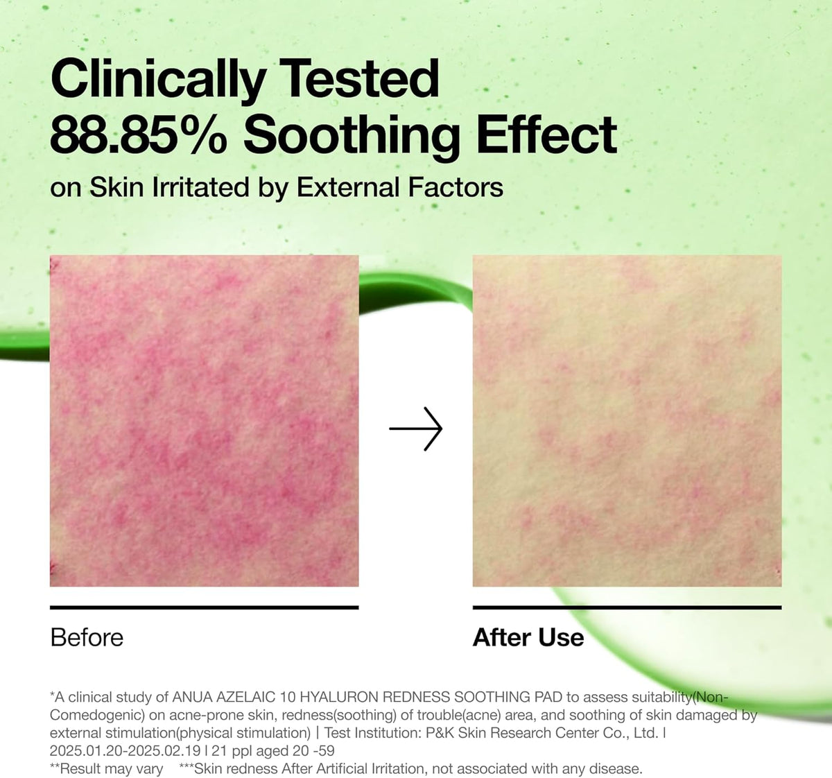 Before and after skin close-ups from a clinical test showing an 88.85% soothing effect on skin irritated by external factors