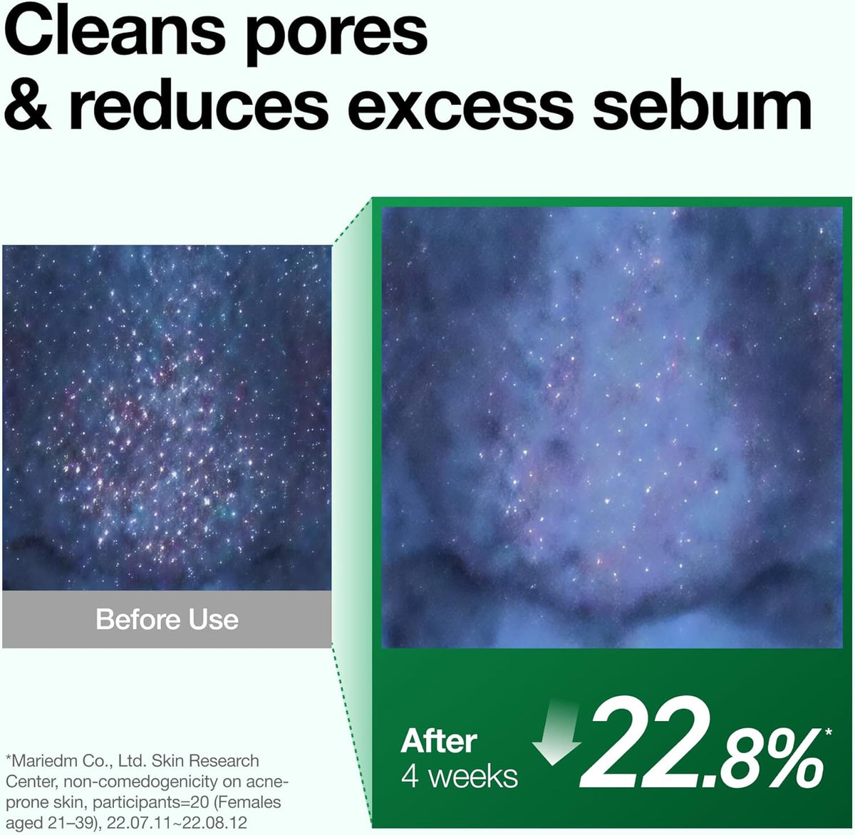 Before and after pore microscope images: cleans pores and reduces excess sebum by 22.8% after four weeks