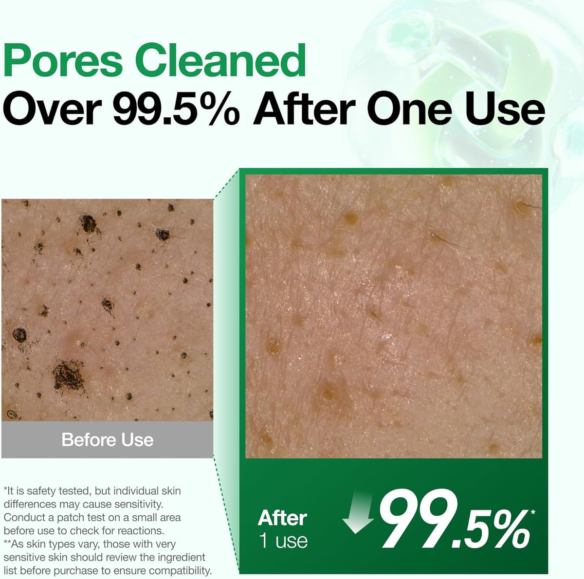 Before and after pore close-ups showing pores cleaned over 99.5% after one use