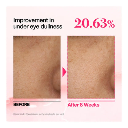Before and after under-eye close-ups showing a 20.63% improvement in under-eye dullness after eight weeks