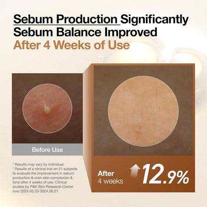 Before and after pore close-ups showing sebum balance improved 12.9% after four weeks