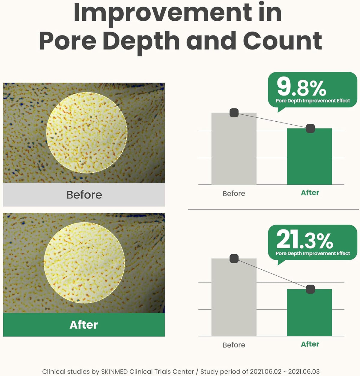 Bar charts with before and after pore images: pore depth improved 9.8% and pore count 21.3%