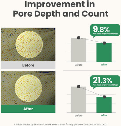 Bar charts with before and after pore images: pore depth improved 9.8% and pore count 21.3%
