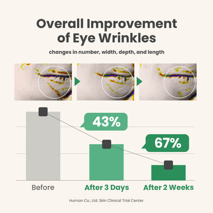 AXIS-Y Vegan Collagen Eye Serum 10ml - eye wrinkle improvement chart with before and after crops