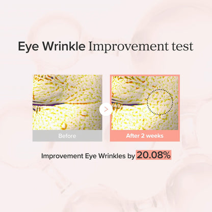 Eye wrinkle improvement test: before and after microscope images showing eye wrinkles improved 20.08% after two weeks