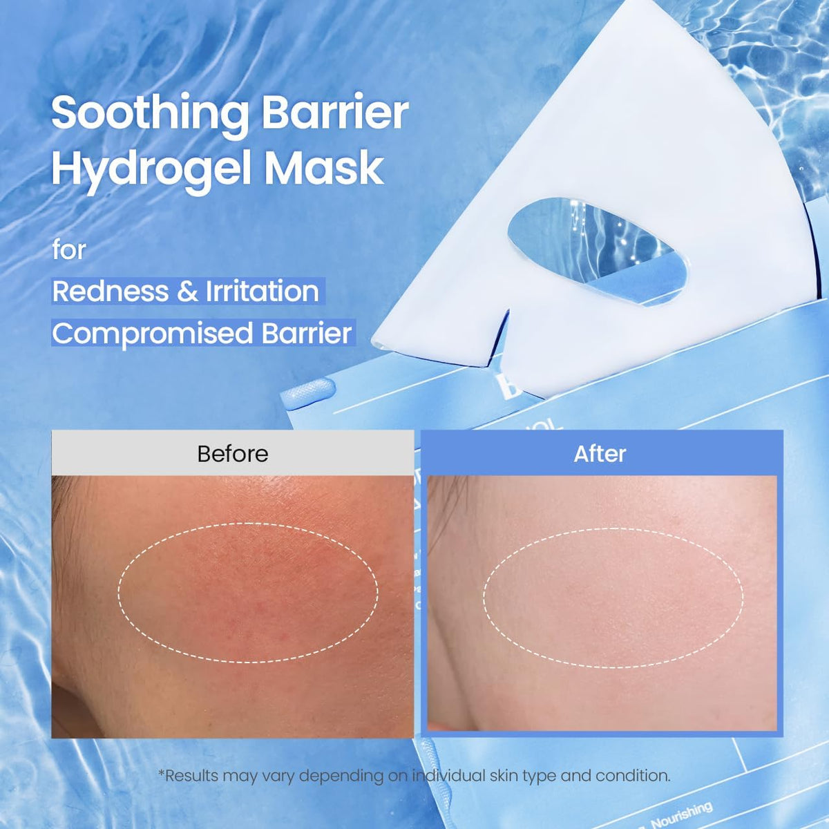 Hydro Cera-nol mask over water with before and after cheek close-ups, a soothing barrier hydrogel mask for redness, irritation and a compromised barrier