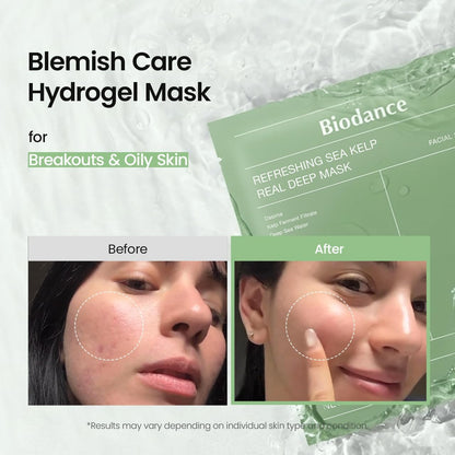 Refreshing Sea Kelp mask pack with before and after cheek photos, a blemish-care hydrogel mask for breakouts and oily skin