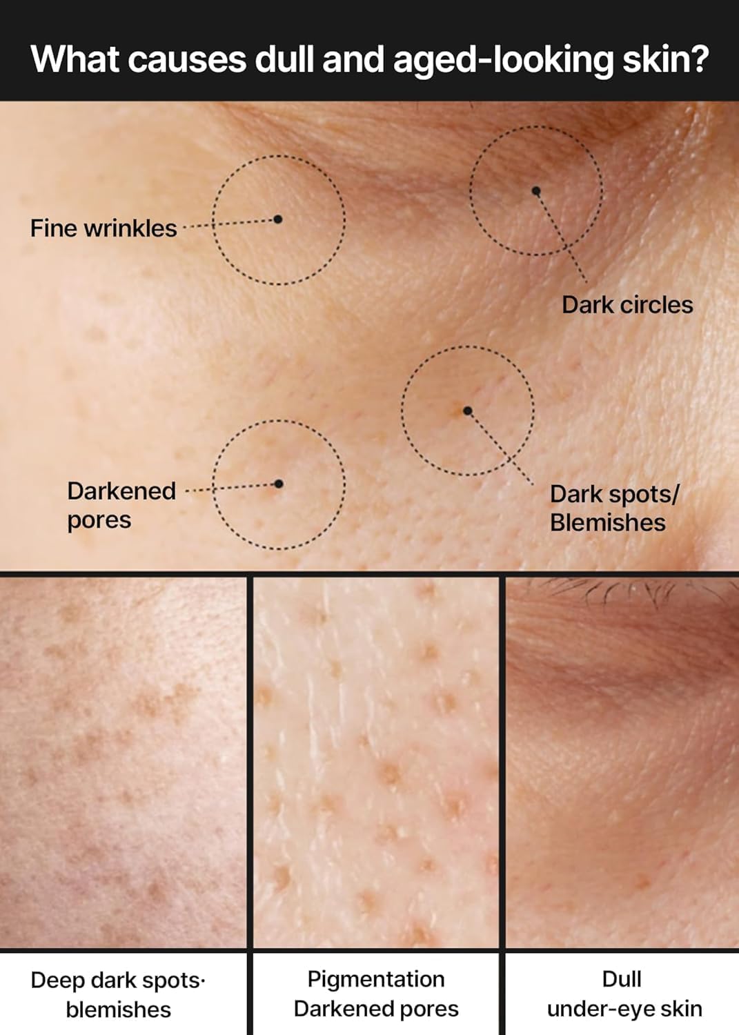 What causes dull and aged-looking skin: a face marked for fine wrinkles, dark circles, darkened pores and dark spots, with three skin close-ups