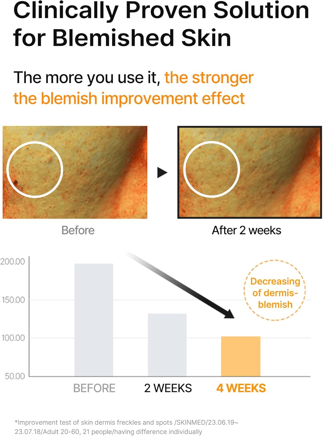 Clinically proven solution for blemished skin: before and after cheek images and a bar chart showing blemishes decreasing over four weeks