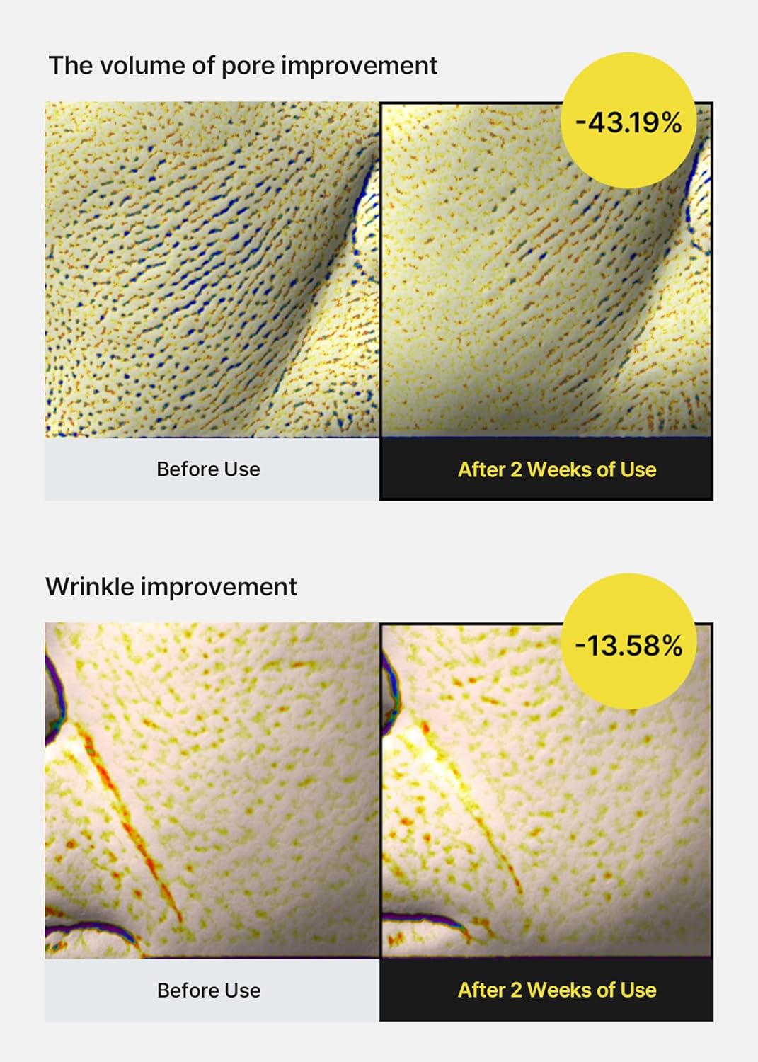 Before and after microscope images after two weeks of use: pore volume improved 43.19% and wrinkles improved 13.58%