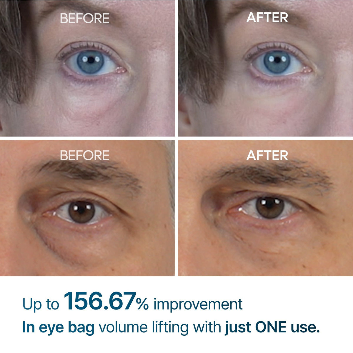 Dr.Melaxin Eyephalt Eyebag Cream 10ml before and after under-eye close-ups, with up to 156.67% improvement in eye bag volume lifting after just one use