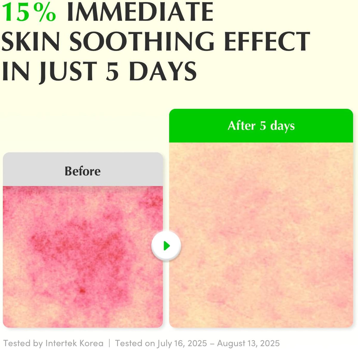 Before and after skin close-ups showing a 15% immediate soothing effect after five days