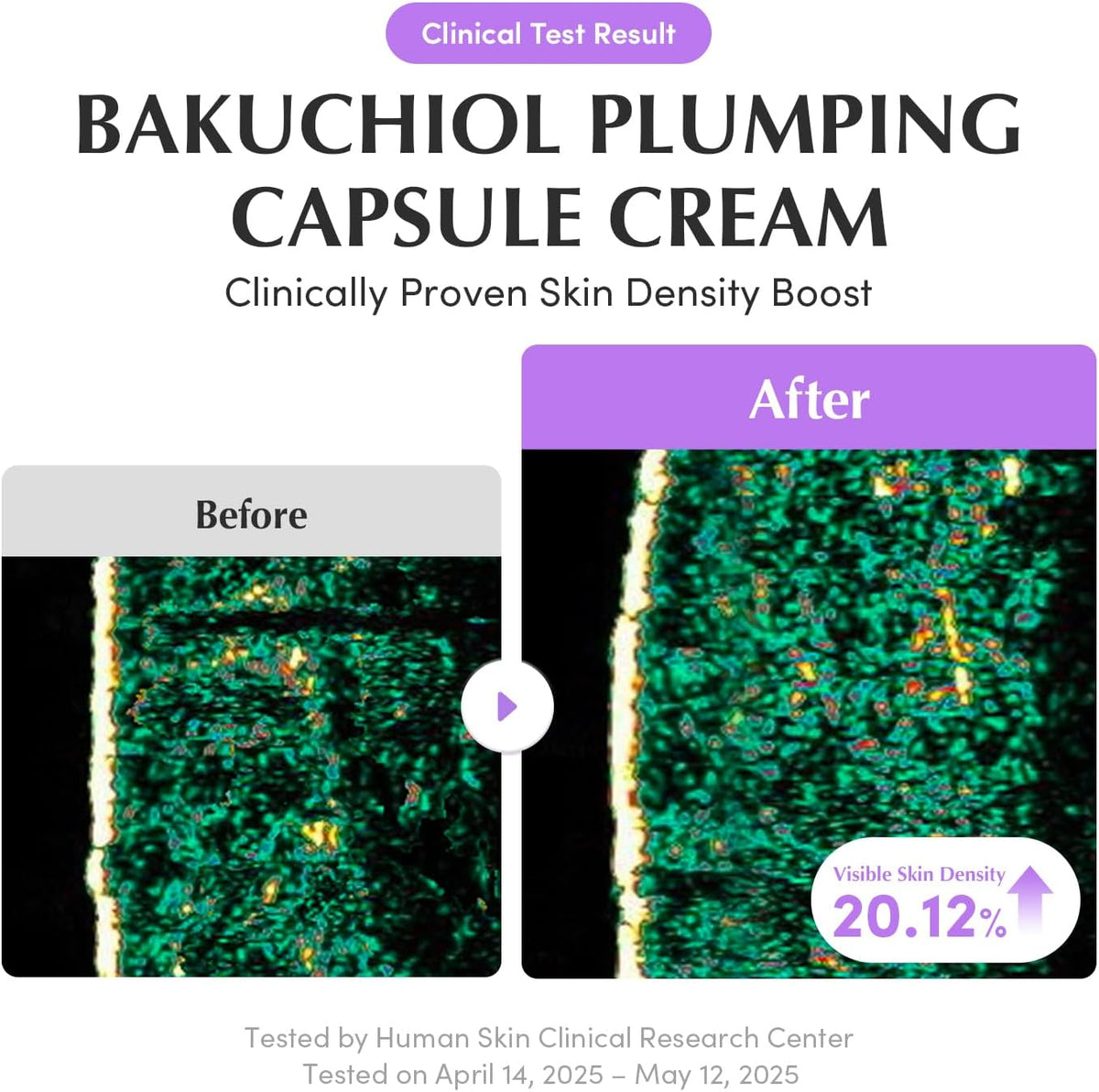 Clinical test result: before and after skin-density images showing visible skin density boosted 20.12%