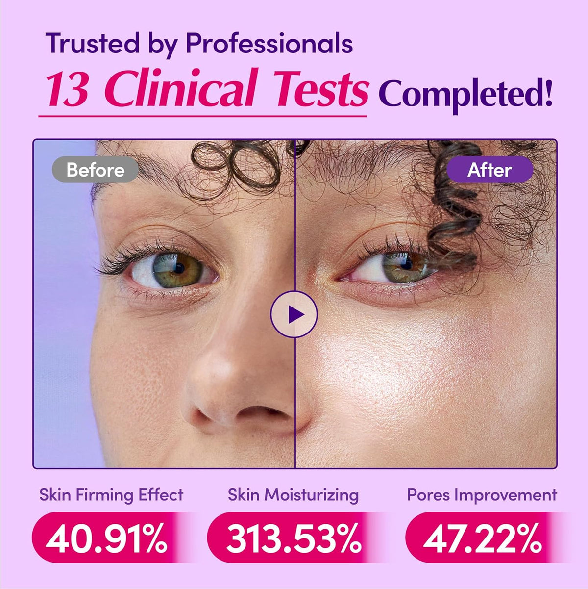 Before and after eye-area close-ups from 13 clinical tests: skin firming 40.91%, moisturising 313.53%, pore improvement 47.22%