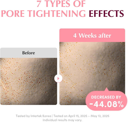 Seven types of pore tightening effects: before and after pore close-ups showing a 44.08% decrease after four weeks