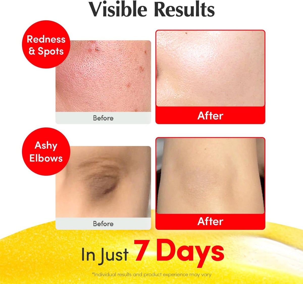 Visible results in seven days: before and after photos of redness and spots on a cheek, and of ashy elbows