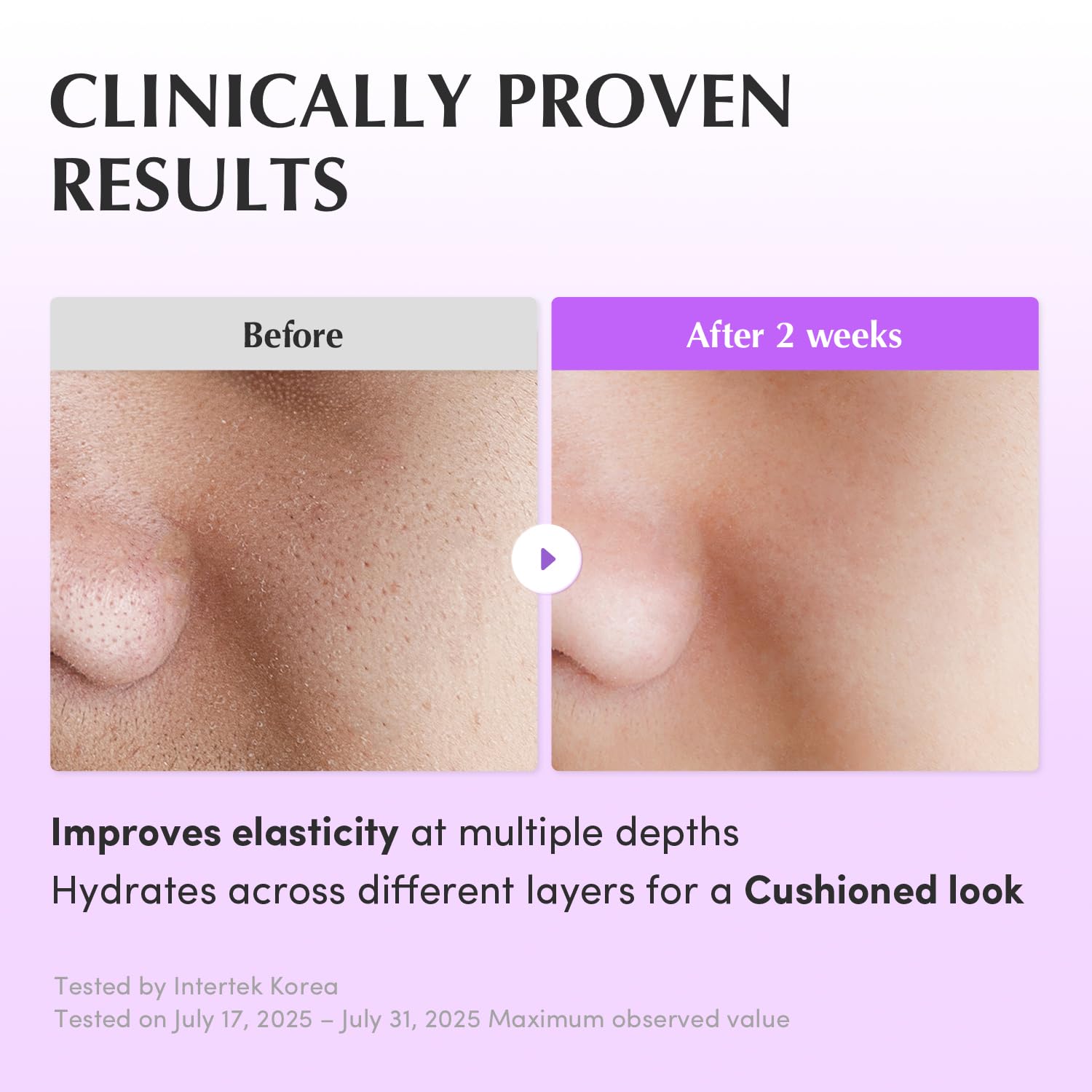 Eqqualberry Bakuchiol Plumping Capsule Toner 150ml - Eqqualberry K-Beauty