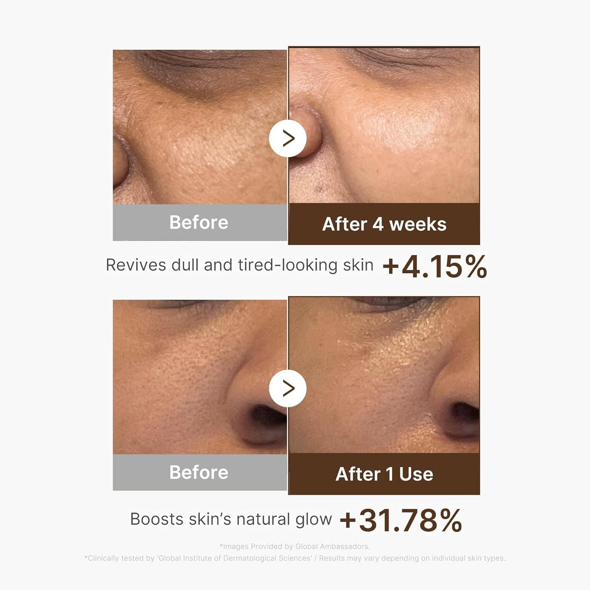 Before and after cheek and nose close-ups: dull skin revived 4.15% after four weeks, natural glow up 31.78% after one use