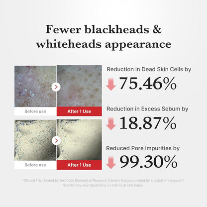 Fewer blackheads and whiteheads: before and after images after one use - dead skin cells down 75.46%, excess sebum down 18.87%, pore impurities down 99.30%
