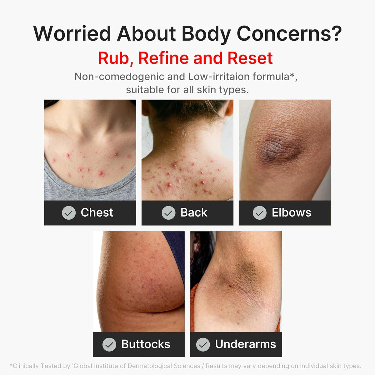 Worried about body concerns: rub, refine and reset, with photos of the chest, back, elbows, buttocks and underarms; non-comedogenic and low-irritation