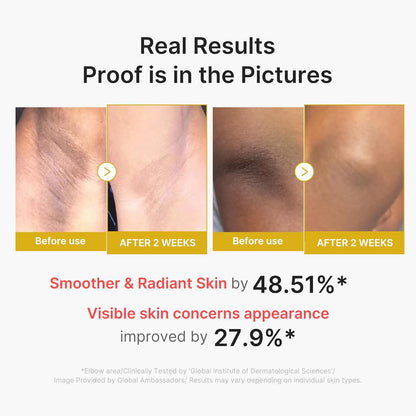 Real results, proof in the pictures: before and after underarm photos at two weeks, smoother skin by 48.51% and visible concerns improved 27.9%