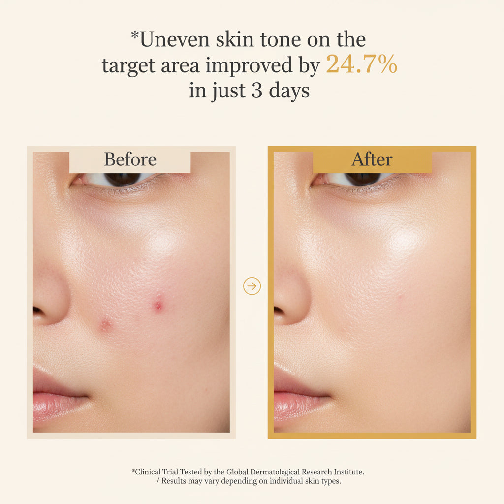 Before and after cheek photos showing uneven skin tone on the target area improved 24.7% in three days