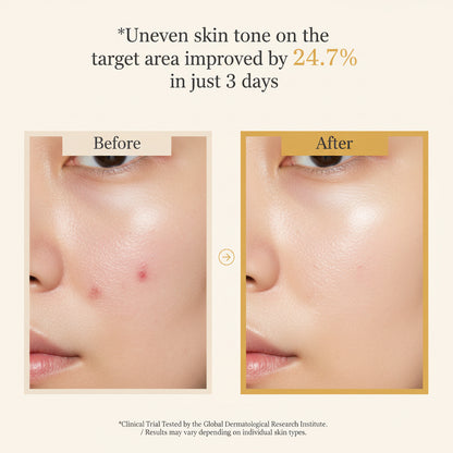 Before and after cheek photos showing uneven skin tone on the target area improved 24.7% in three days