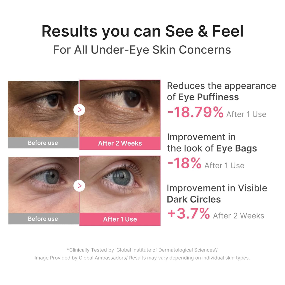 Before and after eye close-ups: eye puffiness reduced 18.79% after one use, eye bags improved 18% after one use, visible dark circles improved 3.7% after two weeks