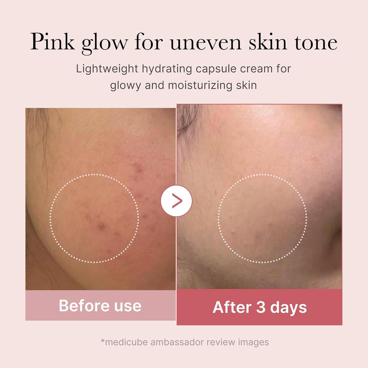 Before and after cheek close-ups after three days of use, showing calmer and more even skin