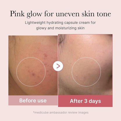 Before and after cheek close-ups after three days of use, showing calmer and more even skin