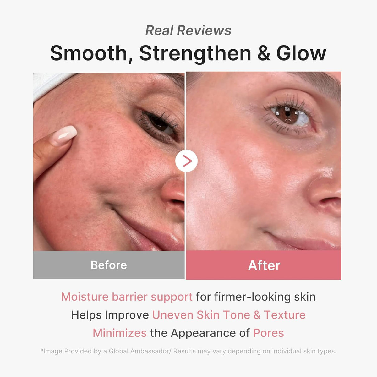 Before and after cheek close-ups from a customer review, showing smoother texture, more even tone and reduced pore appearance