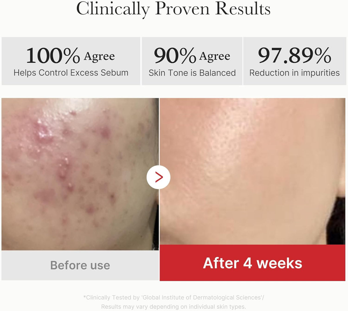 Clinically proven results with before and after cheek photos: 100% agree it controls sebum, 90% agree tone is balanced, 97.89% reduction in impurities