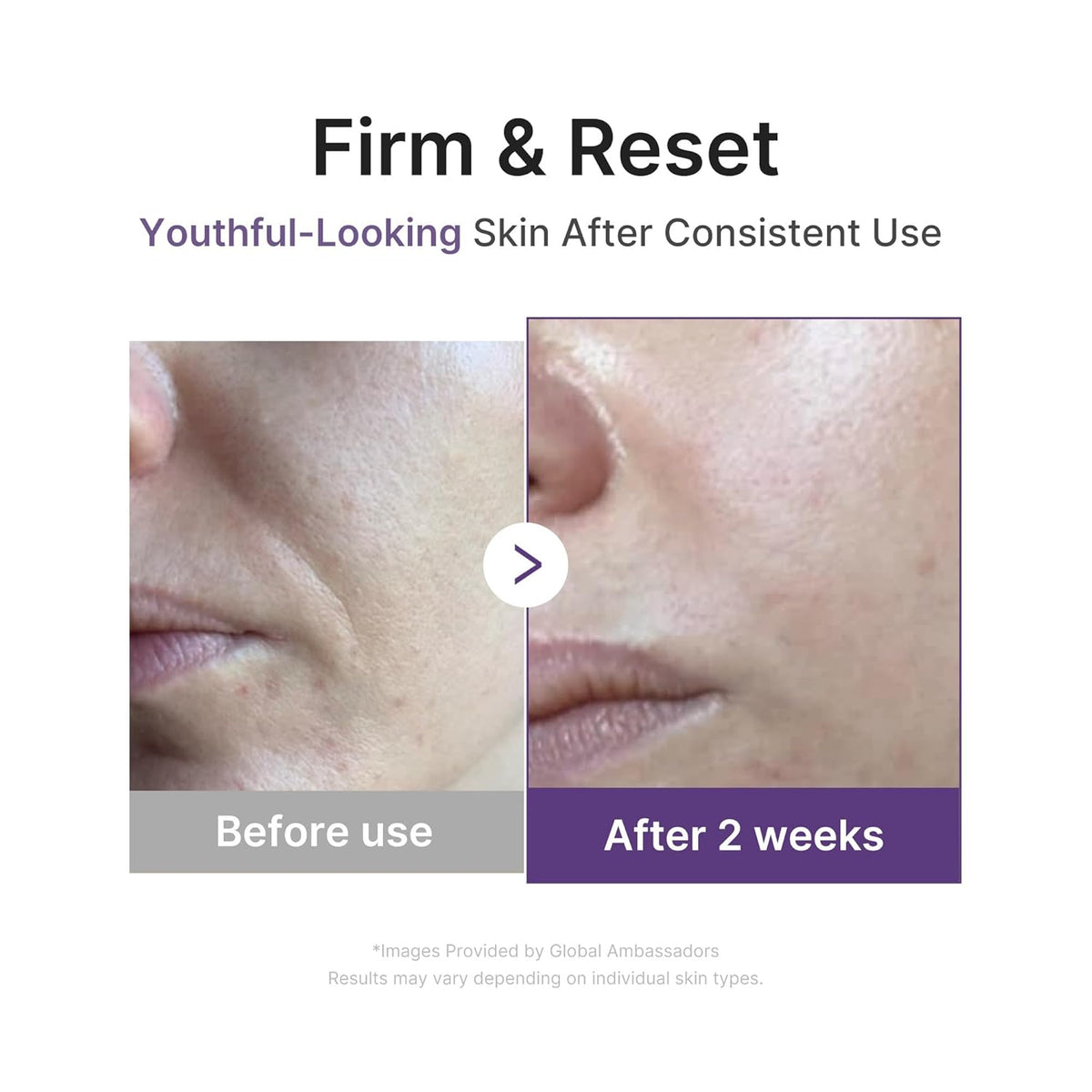 Firm and reset: before and after cheek photos showing youthful-looking skin after two weeks of consistent use