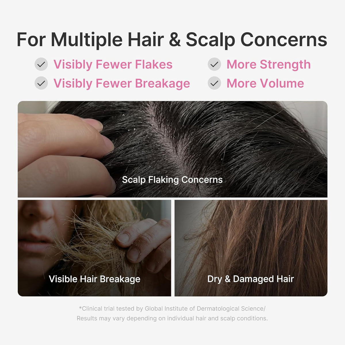 For multiple hair and scalp concerns: photos of scalp flaking, hair breakage and dry damaged hair, with fewer flakes, less breakage, more strength and volume