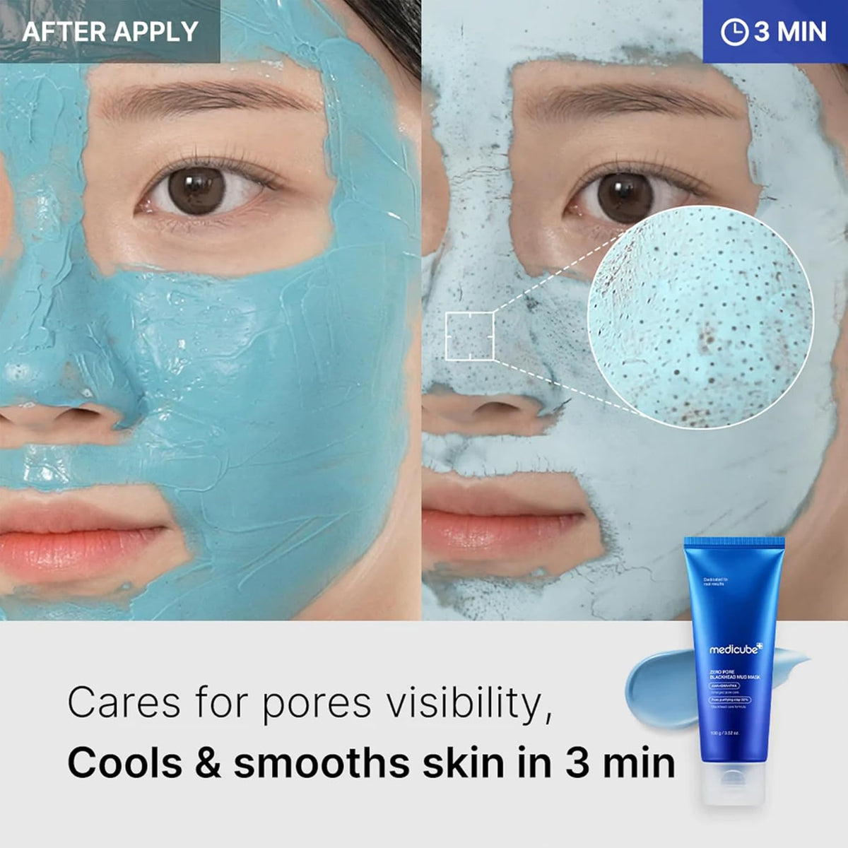 A model wearing the blue clay mask right after applying and again at three minutes, with a close-up of the dried mask lifting pore clots