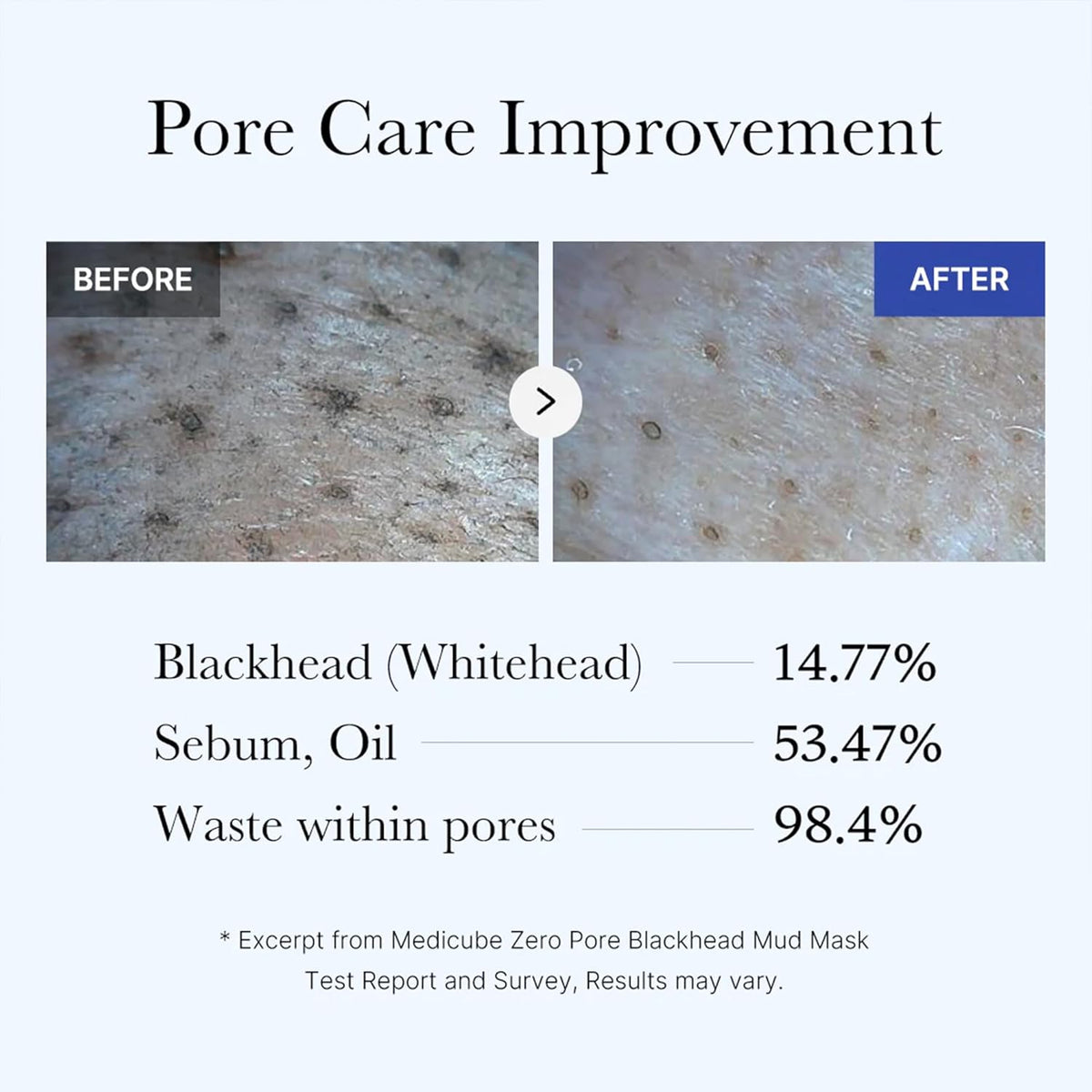 Before and after pore close-ups with test results: blackheads and whiteheads down 14.77%, sebum and oil down 53.47%, waste within pores down 98.4%