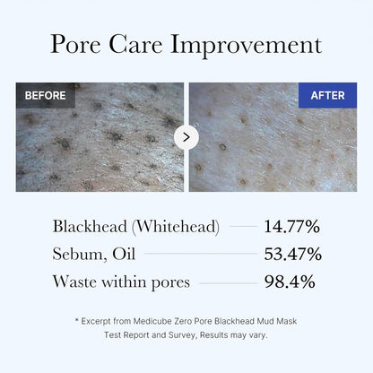 Before and after pore close-ups with test results: blackheads and whiteheads down 14.77%, sebum and oil down 53.47%, waste within pores down 98.4%