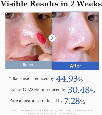 Before and after close-ups of a nose after two weeks: blackheads reduced 44.93%, excess oil and sebum reduced 30.48%, pore appearance reduced 7.28%