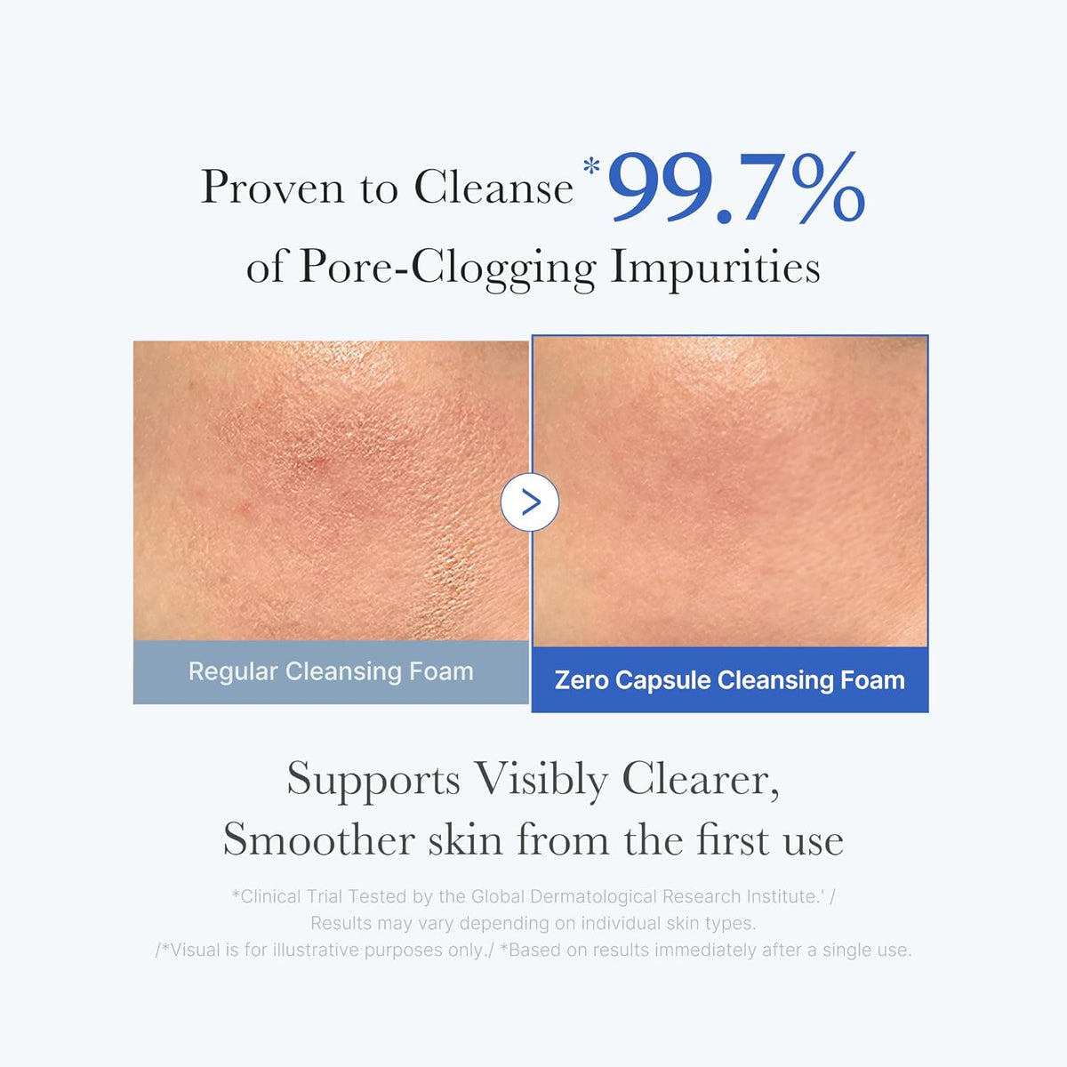 Proven to cleanse 99.7% of pore-clogging impurities: before and after cheek photos comparing a regular cleansing foam with the Zero Capsule foam