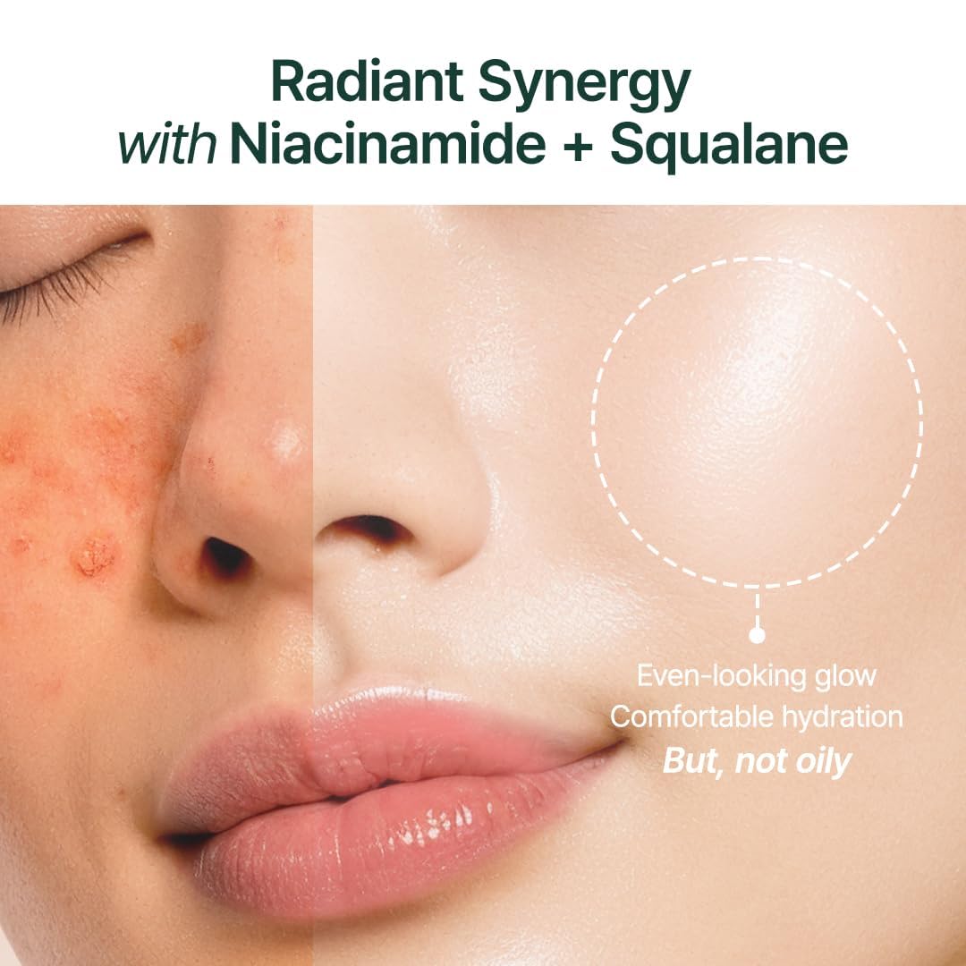 Split face before and after showing an even-looking glow with niacinamide and squalane, comfortable hydration but not oily