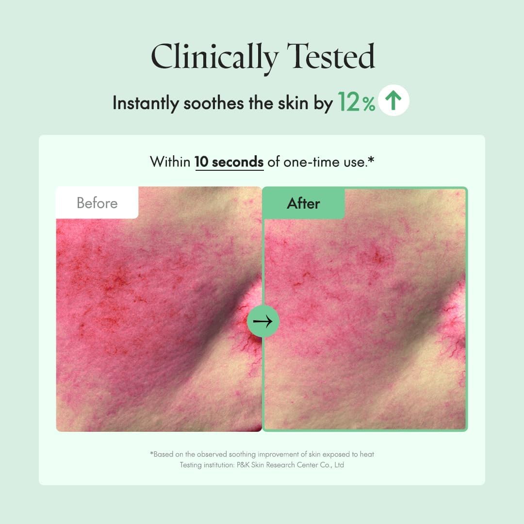 Clinically tested: instantly soothes the skin by 12% within ten seconds of one use, with before and after redness images