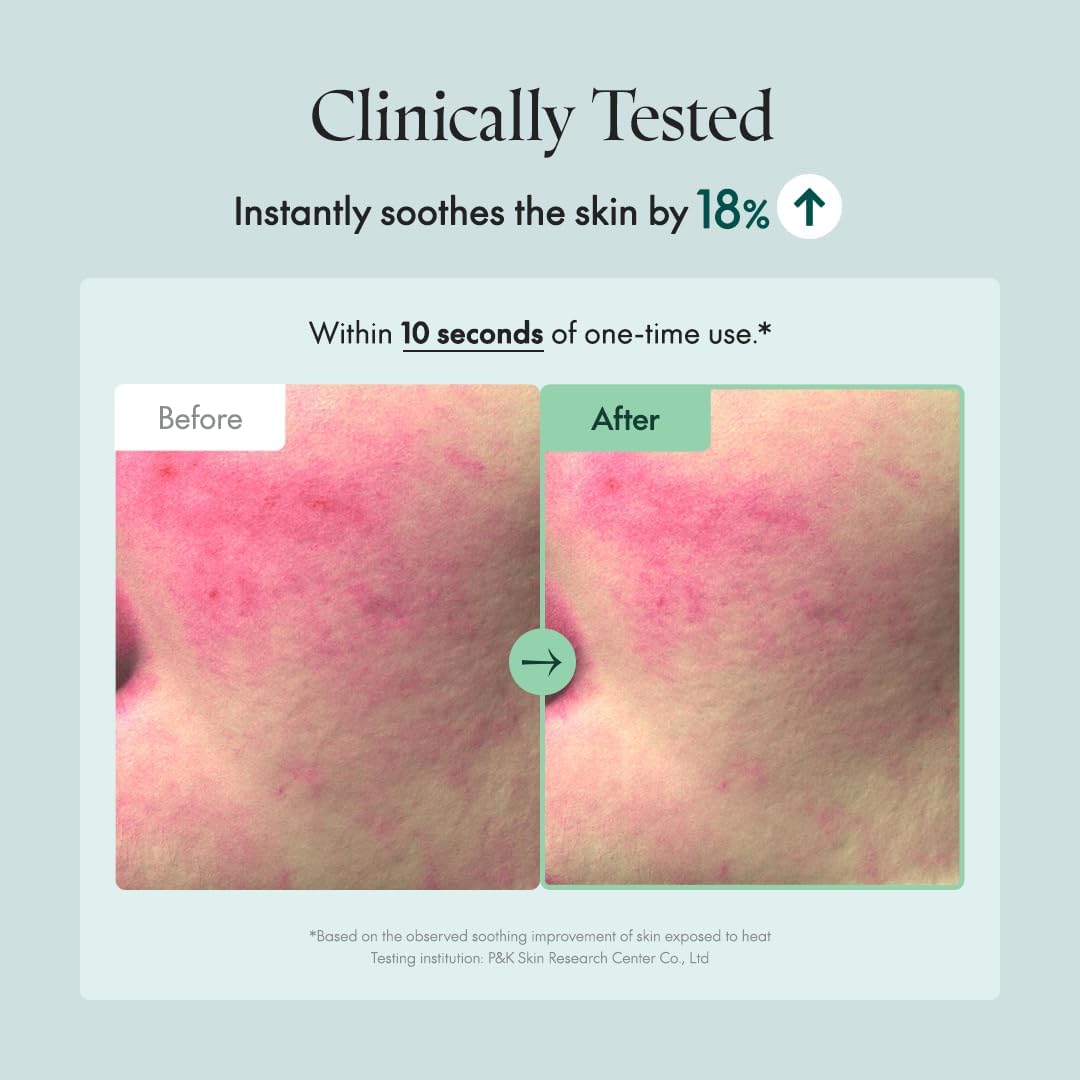 Clinically tested: instantly soothes the skin by 18% within ten seconds of one use, with before and after redness images