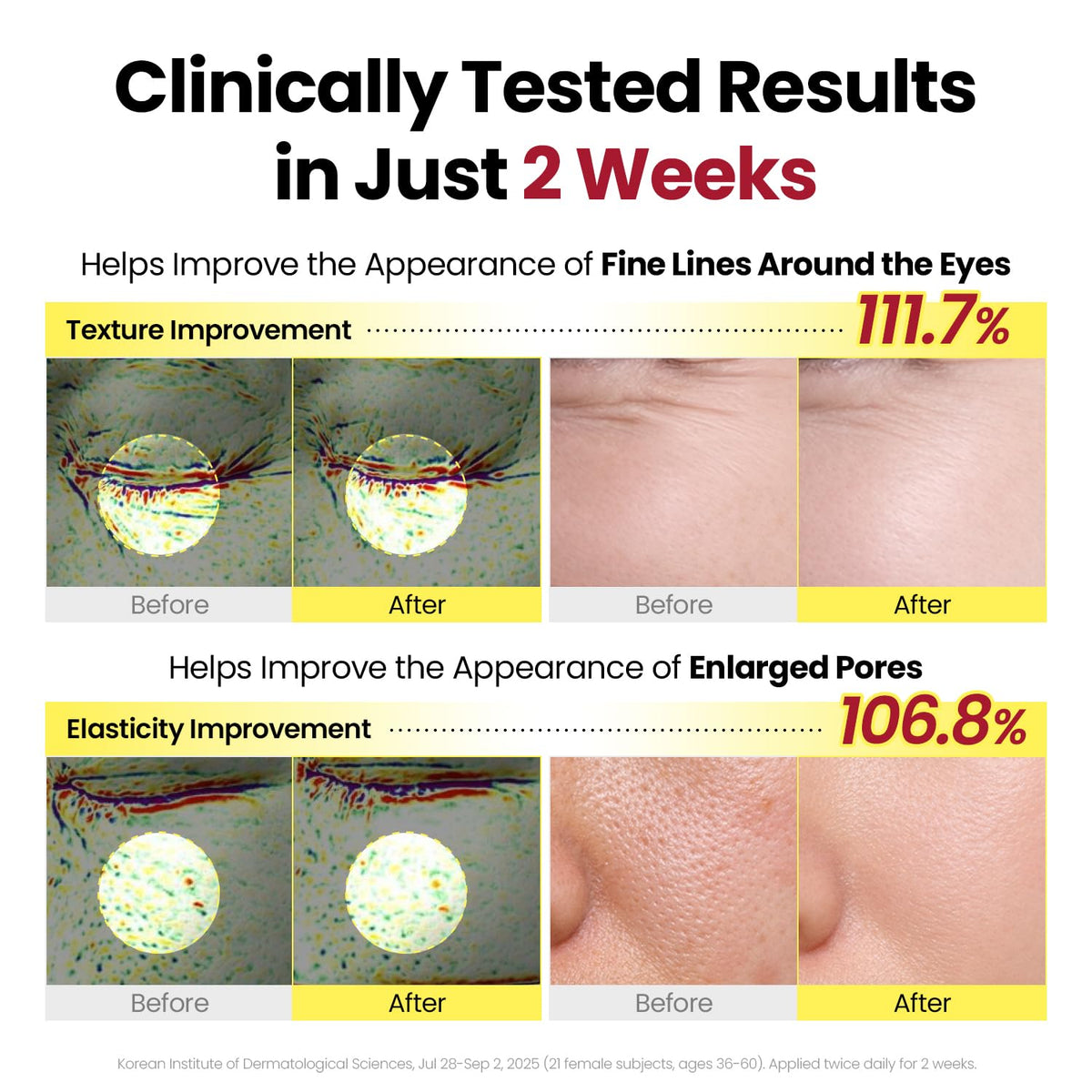 Clinically tested results in two weeks: eye-area texture improved 111.7% and elasticity around enlarged pores 106.8%, with before and after images