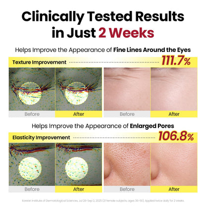 Clinically tested results in two weeks: eye-area texture improved 111.7% and elasticity around enlarged pores 106.8%, with before and after images