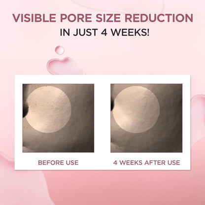 Visible pore size reduction in four weeks: before and after pore close-ups