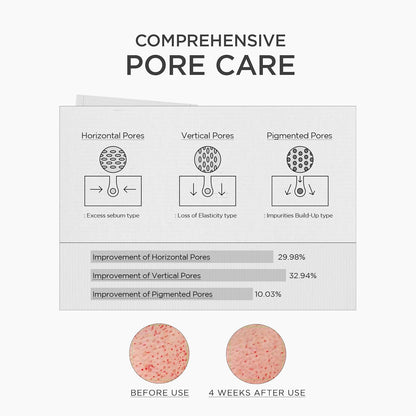 Comprehensive pore care: horizontal pores improved 29.98%, vertical pores 32.94%, pigmented pores 10.03% after four weeks