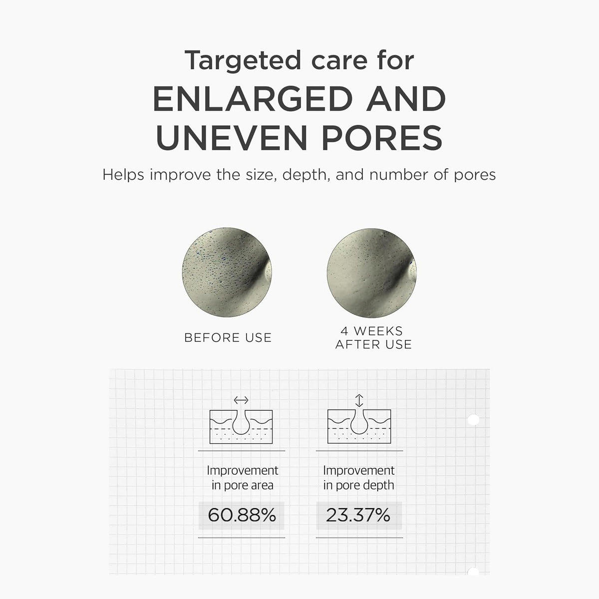 Targeted care for enlarged and uneven pores: pore area improved 60.88% and pore depth 23.37% after four weeks